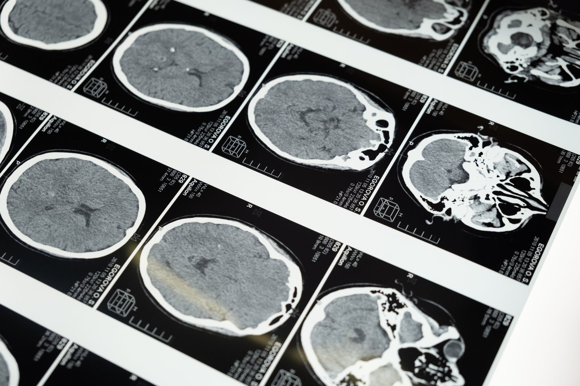 Brain-Mapping Test & It’s Uses in Crime Detection - Forensic's blog